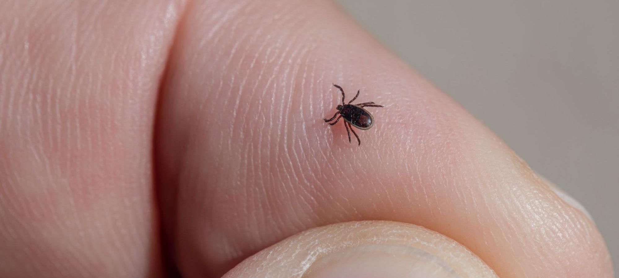 It’s Tick Season! What to Do if You Are Bit!