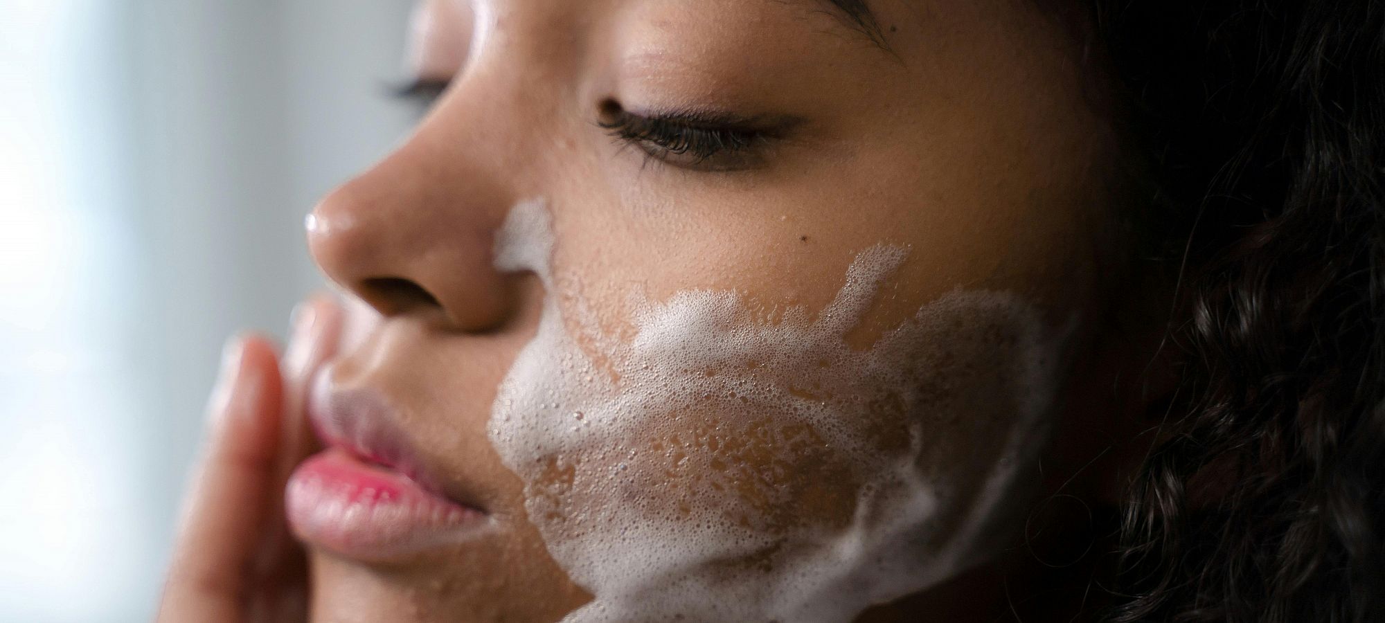 Myths about acne and how to properly understand and treat it